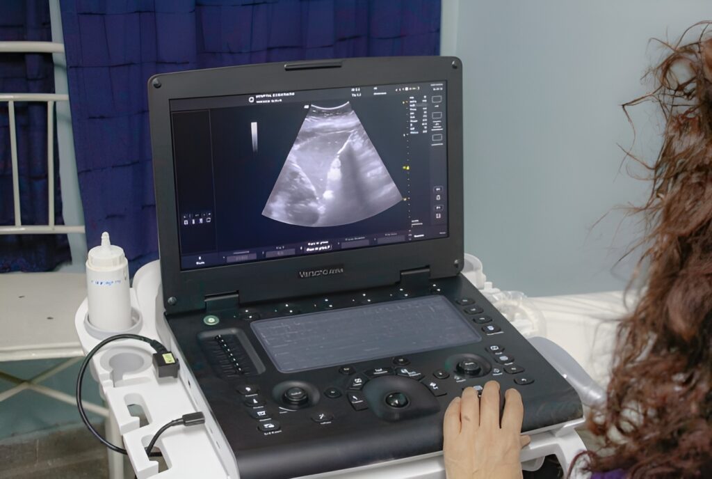 Hospital Teodoro J. Schestakow, ha realizado una inversión de $40 millones en la adquisición de un ecógrafo doppler color